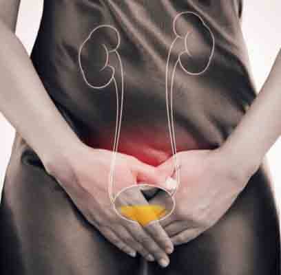 INFECCIONES DE ORINA Y CISTITIS